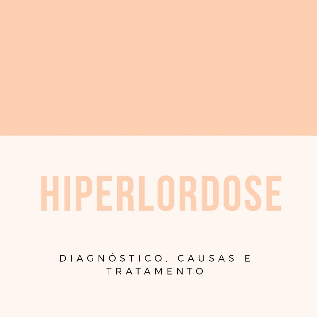 Fisioterapia para Hiperlordose
