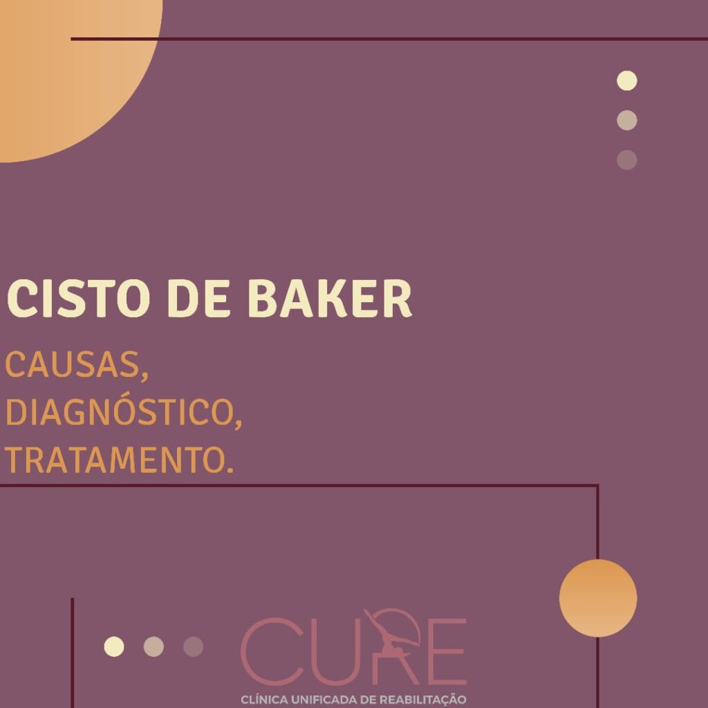 Cisto de Baker: Causas, Sintomas e Tratamento