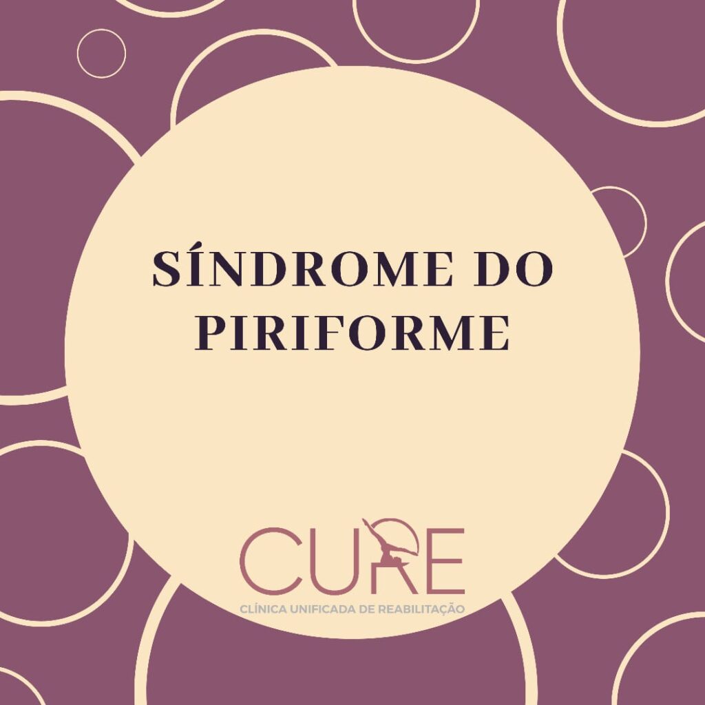 Síndrome do Piriforme: Tratamento com Fisioterapia