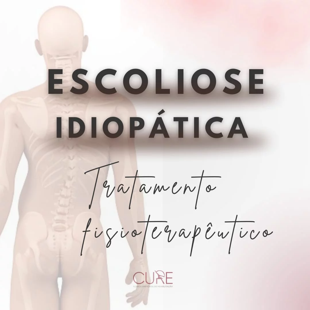 escoliose idiopatica